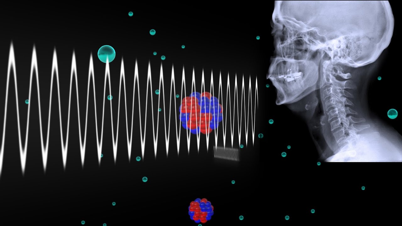 Know what can x rays detect in Rockaway And Enrich Your Knowledge!