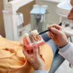 The Silent Revolution: How Dental Implants are Redefining Oral Strength